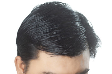 Young Asian men worry about problem hair loss,head bald,dandruff.hair loss problem and Hair...