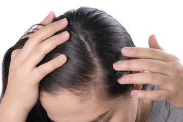 Young Asian women worry about problem hair loss,head bald,dandruff.hair loss problem and Hair treatment concept