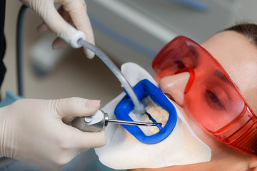 Preparing the oral cavity for whitening with an ultraviolet lamp. Close-up