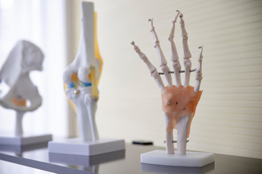 Hands plastic anatomy physiology model a bones in hospital.