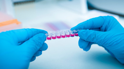 Hands of clinician holding small pink test tubes with colored substance