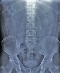 x-ray of the abdominal cavity and pelvis in direct projection, medical research