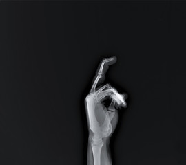 x-ray of hand bones, diagnosis of diseases