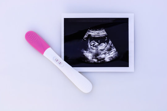 Pregnancy test showing a positive result and ultrasound image.