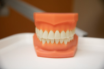 model of teeth show correct spacing of front teeth