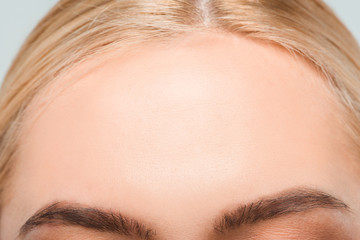 close up of forehead with perfect skin of young woman - obrazy, fototapety, plakaty