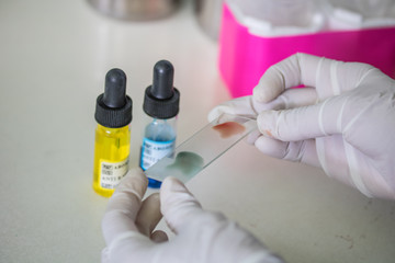 Blood test for blood type.