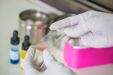 Blood test for blood type.