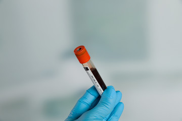 Doctor's hand with medical glove holding a blood probe. in front of a lab