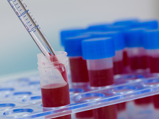 close up of using a pipette for a blood probe tube