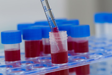 close up of handling blood with pipette on a tube rack