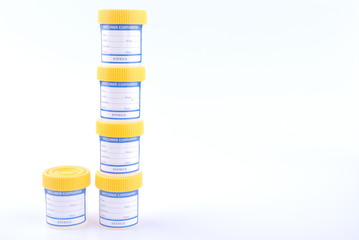 bottles of urine test sample