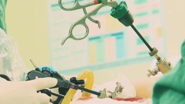 Video Laparoscopia