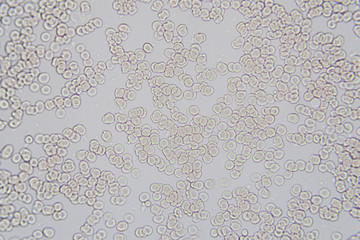 Blood cells microscopic image magnification x 400