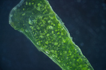 Lettuce cells under microscope, magnification x 100 dark field technique