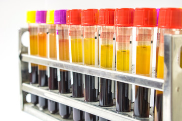 Test tubes for blood in laboratory isolated on a white background.