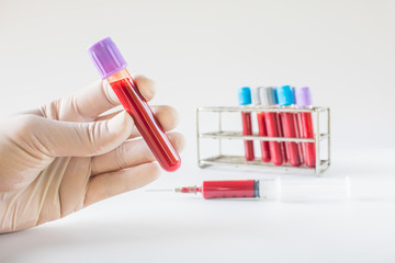 Test tubes for blood and hand in laboratory isolated on a white background.