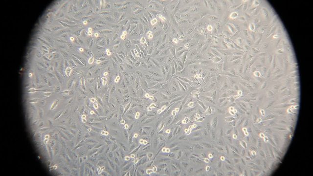 Focusing with an optical microscope on a layer of human cancer cells