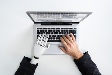 Man With Prosthetic Hand Working On Laptop