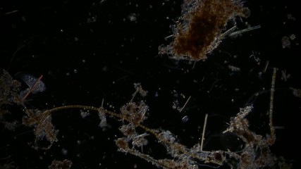 microorganism in pond water under microscope unicellular organisms