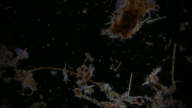 microorganism in pond water under microscope unicellular organisms