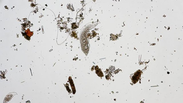 microorganism in pond water under microscope unicellular organisms