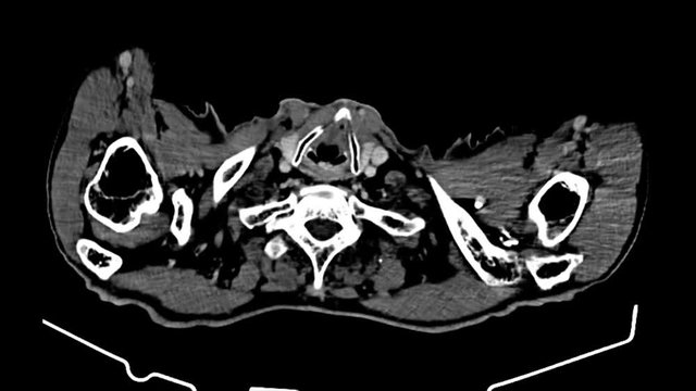 Human MRI Scan,  X-ray  - XRay Magnetic Resonance imaging , Ultra HD 4k