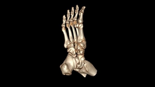 CT Scan of foot with 3D rendering technic. 4K resolution.