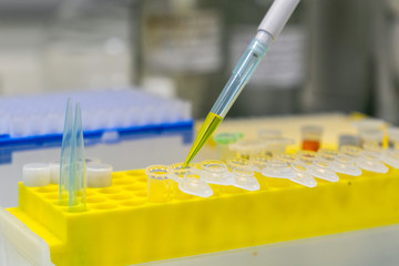 Close-up of a plastic pipette tip with a yellow solution when pouring into a disposable tube. The concept of using plastic dishes in modern science. Zero waste idea