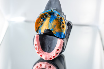 Close-up studio shot of jaw impressions for implants modeling