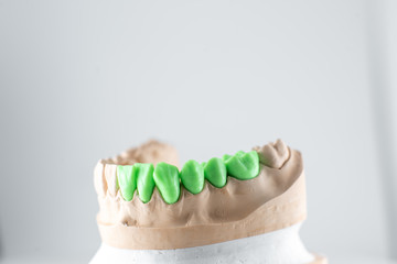 Close-up on plaster model of artificial jaw with teeth painted in green on the white background....
