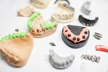 Various of artificial jaw models with dental implants and crowns on the white background. Concept of aesthetic dentistry and implantation technology