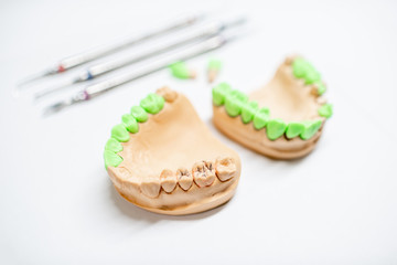 Plaster models of artificial jaw with teeth painted in green and dental tools on the white background. Concept of aesthetic dentistry and implantation