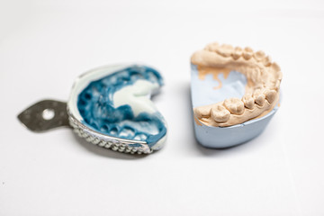 Artificial plaster jaw model with impression on the white background. Manufacture of molds for dentures in laboratory