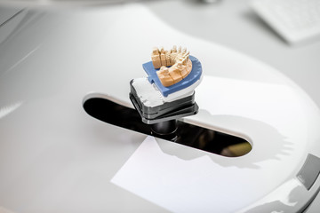 Scanning jaw model on the 3rd scanner in the laboratory, for the manufacture of dentures or implants, close-up