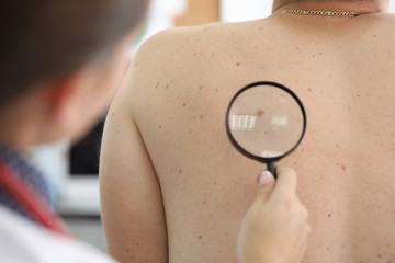 Medical worker checking birthmark