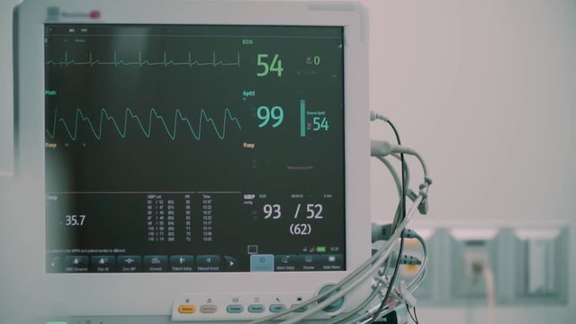 Modern medical operation room in which doctors look into monitors with biometric data