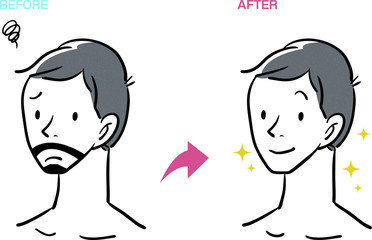 ヒゲ 脱毛 男性 泥棒ヒゲ ビフォーアフター ベクター