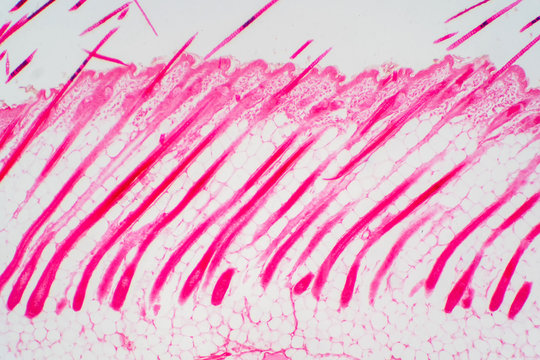Cross section human skin head under microscope view for education pathology.