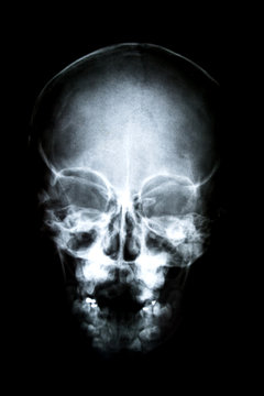 X-ray of head / Many others X-ray images in my portfolio.