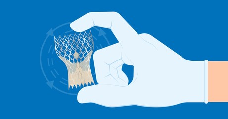 Transcatheter aortic valve replacement (TAVR) minimally invasive surgery