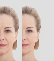 Beautiful middle-age woman face before after cosmetic procedures. Skin care for wrinkled face. Before-after anti-aging facelift treatment. Facial skincare and contouring. - obrazy, fototapety, plakaty