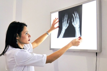 Smart woman doctor check hand bones film x-ray image from machine.