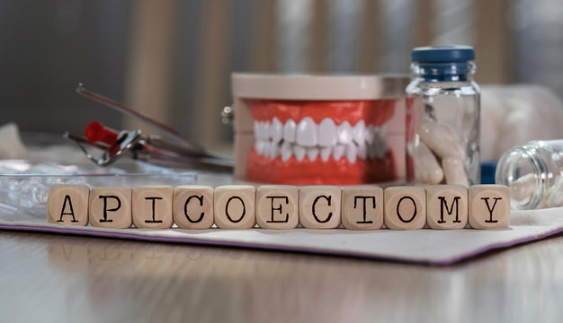 Word APICOECTOMY composed of wooden dices. Pills, documents, pen, human jaw model in the background.