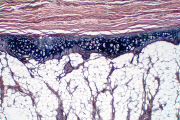 Human hyaline cartilage bone under microscope view for education pathology.