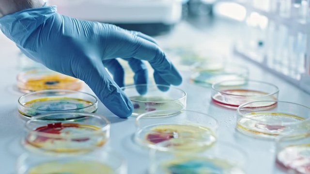 Scientist Works with Petri Dishes with Various Bacteria, Tissue and Blood Samples