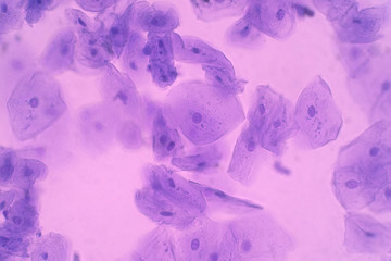 Human Cheek Epithelial Cells. The tissue that lines the inside of the mouth is known as the basal mucosa and is composed of squamous epithelial cells.