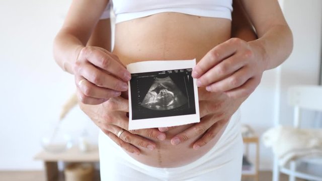 Man And Pregnant Woman Holding Ultrasound Photo On Belly.