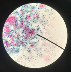 Cells in reproductive female cytology and histology concept.