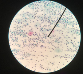 Cells in reproductive female cytology and histology concept.